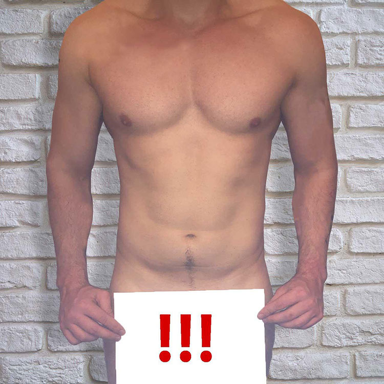 Syphilis ernstzunehmende Geschlechtskrankheit!